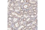 Immunohistochemical staining of human kidney shows moderate membranous and nuclear positivity in cells in tubules.