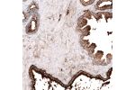 Immunohistochemical staining of human prostate shows strong cytoplasmic positivity in glandular cells.
