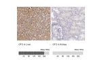 Immunohistochemistry analysis in human liver and kidney tissues using HPA000570 antibody. Corresponding OTC RNA-seq data are presented for the same tissues.