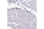 Immunohistochemical staining of human skeletal muscle shows moderate nuclear membrane positivity in myocytes.