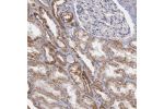 Immunohistochemical staining of human kidney shows granular cytoplasmic positivity in cells in tubules.