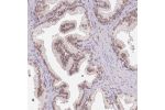 Immunohistochemical staining of human testis shows moderate nuclear positivity in cells in seminiferous ducts and Leydig cells.