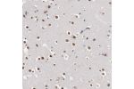 Immunohistochemical staining of human hippocampus shows moderate nuclear positivity in neuronal cells.