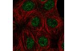 Immunofluorescent staining of human cell line MCF7 shows localization to nucleoplasm.