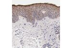 Immunohistochemical staining of human skin shows moderate cytoplasmic positivity mainly in keratinocytes.