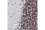 Immunohistochemical staining of human cerebellum shows strong nuclear positivity in purkinje cells and cells in granular layer.