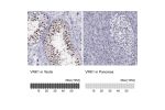 Immunohistochemistry analysis in human testis and pancreas tissues using HPA000660 antibody. Corresponding VRK1 RNA-seq data are presented for the same tissues.