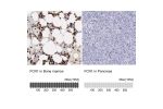 Immunohistochemistry analysis in human bone marrow and pancreas tissues using HPA000685 antibody. Corresponding FCN1 RNA-seq data are presented for the same tissues.