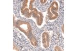 Immunohistochemical staining of human endometrium shows moderate cytoplasmic positivity in glandular cells.
