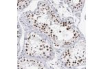 Immunohistochemical staining of human Testis shows strong nuclear positivity in cells in seminiferous ducts.