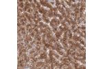 Immunohistochemical staining of human liver shows moderate to strong cytoplasmic positivity in hepatocytes.