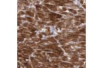Immunohistochemical staining of human heart muscle shows strong cytoplasmic positivity in myocytes.