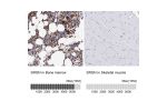 Immunohistochemistry analysis in human bone marrow and skeletal muscle tissues using HPA000759 antibody. Corresponding SRGN RNA-seq data are presented for the same tissues.