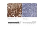 Immunohistochemistry analysis in human adrenal gland and duodenum tissues using Anti-RDX antibody. Corresponding RDX RNA-seq data are presented for the same tissues.