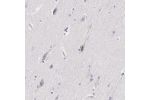 Immunohistochemical staining of human cerebral cortex shows strong cytoplasmic positivity in neurons.
