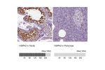 Immunohistochemistry analysis in human testis and pancreas tissues using HPA000798 antibody. Corresponding HSPA2 RNA-seq data are presented for the same tissues.