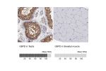 Immunohistochemistry analysis in human testis and skeletal muscle tissues using HPA000834 antibody. Corresponding G6PD RNA-seq data are presented for the same tissues.