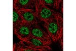 Immunofluorescent staining of human cell line MCF7 shows localization to nucleoplasm.