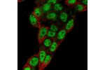 Immunofluorescent staining of human cell line Hep G2 shows localization to nucleoplasm.