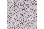 Immunohistochemistry analysis in human prostate and lymph node tissues using Anti-H1F0 antibody. Corresponding H1F0 RNA-seq data are presented for the same tissues.