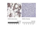 Immunohistochemistry analysis in human bone marrow and pancreas tissues using Anti-MCM5 antibody. Corresponding MCM5 RNA-seq data are presented for the same tissues.