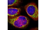 Immunofluorescent staining of human cell line A-431 shows localization to mitochondria.
