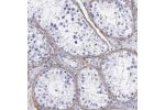 Immunohistochemical staining of human testis shows distinct positivity in fibrous capsule.
