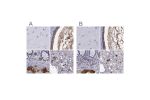 Immunohistochemical staining of human cerebral cortex, cervix, uterine, colon and liver using Anti-SERPINA3 antibody HPA000893 (A) shows similar protein distribution across tissues to independent antibody HPA002560 (B).
