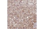 Immunohistochemical staining of human adrenal gland shows moderate membranous and cytoplasmic positivity in glandular cells.