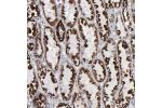 Immunohistochemical staining of human kidney shows strong positivity in mitochondria in cells in tubules.