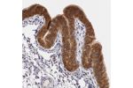 Immunohistochemical staining of human breast shows strong cytoplasmic positivity in glandular cells.