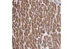 Immunohistochemical staining of human heart muscle shows moderate cytoplasmic positivity in myocytes.