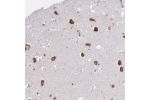 Immunohistochemical staining of human hippocampus shows strong cytoplasmic positivity in neuronal cells.