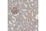 Immunohistochemical staining of human kidney shows moderate membranous positivity in glomerular cells.
