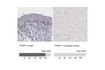 Immunohistochemistry analysis in human skin and cerebral cortex tissues using HPA000937 antibody. Corresponding TYRP1 RNA-seq data are presented for the same tissues.