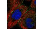 Immunofluorescent staining of human cell line A-431 shows localization to cell junctions.