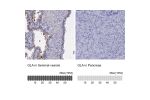 Immunohistochemistry analysis in human seminal vesicle and pancreas tissues using Anti-GLA antibody. Corresponding GLA RNA-seq data are presented for the same tissues.