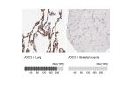 Immunohistochemistry analysis in human lung and skeletal muscle tissues using HPA000980 antibody. Corresponding AOC3 RNA-seq data are presented for the same tissues.