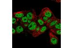 Immunofluorescent staining of human cell line Hep G2 shows localization to nucleoplasm.