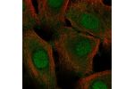 Immunofluorescent staining of human cell line hTCEpi shows localization to nucleus & cytosol.