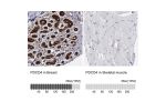 Immunohistochemistry analysis in human breast and skeletal muscle tissues using HPA001032 antibody. Corresponding PDCD4 RNA-seq data are presented for the same tissues.
