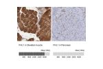 Immunohistochemistry analysis in human skeletal muscle and pancreas tissues using HPA001040 antibody. Corresponding FHL1 RNA-seq data are presented for the same tissues.