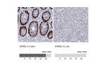 Immunohistochemistry analysis in human colon and liver tissues using HPA001042 antibody. Corresponding SATB2 RNA-seq data are presented for the same tissues.