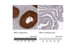 Immunohistochemistry analysis in human epididymis and fallopian tube tissues using Anti-BMX antibody. Corresponding BMX RNA-seq data are presented for the same tissues.