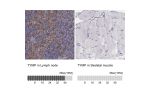Immunohistochemistry analysis in human lymph node and skeletal muscle tissues using HPA001072 antibody. Corresponding TYMP RNA-seq data are presented for the same tissues.