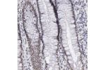 Immunohistochemical staining of human rectum shows nuclear positivity in glandular cells.