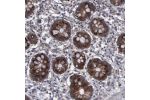 Immunohistochemical staining of human small intestine shows strong cytoplasmic positivity in glandular cells.