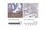 Immunohistochemistry analysis in human seminal vesicle and skeletal muscle tissues using Anti-FLNA antibody. Corresponding FLNA RNA-seq data are presented for the same tissues.