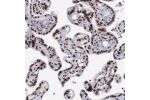 Immunohistochemical staining of human placenta shows strong nuclear positivity in trophoblastic cells.