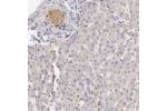 Immunohistochemical staining of human liver shows moderate positivity in erythrocytes.